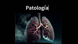 Absceso Pulmonar [upl. by Jessy]