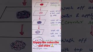 ZiehlNeelsen staining  Acid Fast staining procedure process viral youtubeshorts science short [upl. by Alcinia647]