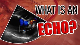 What is an Echocardiogram [upl. by Erna]