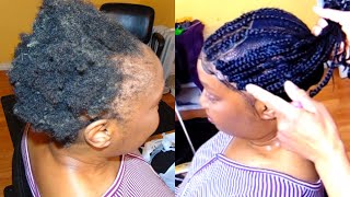 BEST Crochet Braid Method FOR Thin Edges 10k viralvideo fyp [upl. by Kain285]