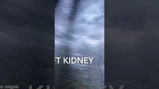 Bilateral Renal Parenchyma Disease Grade 2 ultrasound video viral shorts like subscribe [upl. by Gollin]