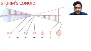 Sturms conoid amp Its clinical application by Dr Pradeep DubeyImagination amp Animation [upl. by Ruphina]