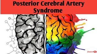 Posterior Cerebral Artery SyndromePosterior Cerebral Artery StrokePart 2Vascular Strokes [upl. by Ayaj466]