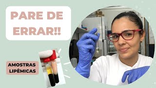 O que fazer com AMOSTRAS LIPÊMICAS  COMO DILUIR JEJUM COMO LER no equipamento [upl. by Garwin]