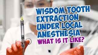 Wisdom Tooth Extraction Under Local Anesthesia  My Experience [upl. by Watkin]