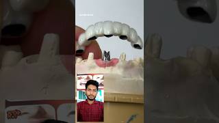 All in one metal ceramics capshortvideo dental new satisfying [upl. by Pallaten169]