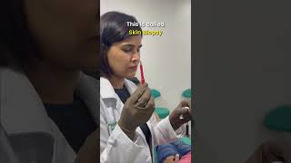 Skin Biopsy 💉🧏‍♀️ Procedure By Dermatologist  Dr Priyanka Reddy  DNA Skin Clinic  shorts [upl. by Adnuahsal]