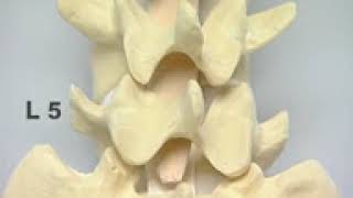 Pedicle Identification spine surgery YouTube [upl. by Nylorahs]