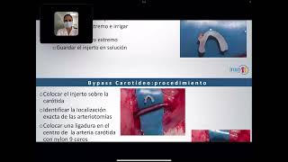 Tema  Bypass Carotideo [upl. by Cherilynn196]