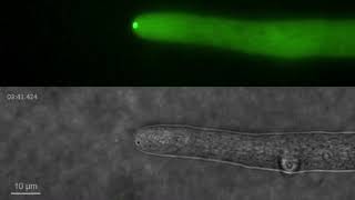 Spitzenkörper in filamentous fungus Neurospora crassa [upl. by Demetra915]