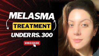 Melasma Removal at Home I Melasma Remove cream under Rs 300 I Melasma Skin Care Regimen Routine [upl. by Mischa]