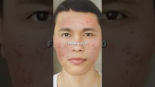 Zuniga on Natural Face Mask Glow Up in 7 Days [upl. by Vashti816]