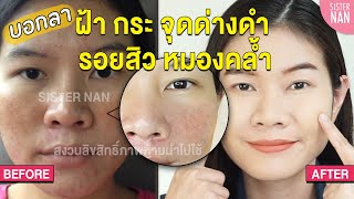 ลดรอยดำ รอยสิว จุดด่างดำ ฝ้า กระ โทรม หมองคล้ำ หน้าพัง หน้าสว่างขึ้น หน้ากระจ่างใส  แนน Sister Nan [upl. by Yelknirb]