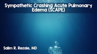 Sympathetic Crashing Acute Pulmonary Edema [upl. by Nipsirc]