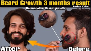 Dermaroller for beard growth  Derma roller beard before and after  Beard Products  review [upl. by Soutor]