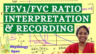 FEV1FVC ratio  obstructive Vs restrictive disease  Dynamic lung volume  Respiratory physiology [upl. by Naitsihc]