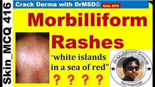 Morbilliform RASH  DENGUE  MEASLES  RUBELLA  HERPES ZOSTER  Viral Infections  MACULOPAPULAR [upl. by Yentruok]