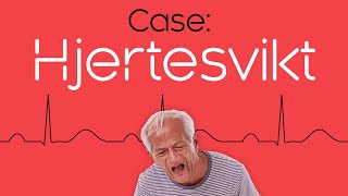 Case 2 Hjertesvikt [upl. by Iver60]