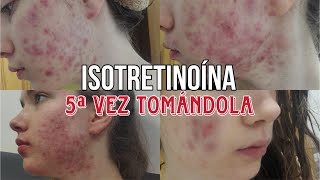 5ª VEZ TOMANDO ISOTRETINOÍNA RoaccutanAccutane  MI EXPERIENCIA  FOTOS del proceso [upl. by Gitel]