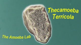 Amoeba  Thecamoeba Terricola by The AmoebaLab [upl. by Adnarram130]