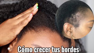 Cómo hacer CRECER el CABELLO de las ENTRADAS  Cómo hacer crecer el cabello de los bordes  Rihanel [upl. by Broder]