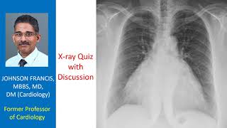 Xray Quiz with Discussion [upl. by Charmane716]