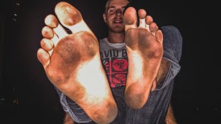 I Walked Barefoot for 2 Years… Shocking Results [upl. by Aneerhs952]