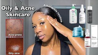 SKINCARE ROUTINE FOR OILY ACNEPRONE SKIN  A routine for smooth amp clear Skin ‼️ [upl. by Christoforo]