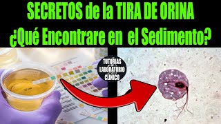 🔥 Descubre el SECRETO DEFINITIVO ¿Que Encontraré en el SEDIMENTO URINARIO según la TIRA DE ORINA🔬 [upl. by Clerissa]