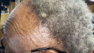 “From Hair Loss To Crochet Box Braids A Traction Alopecia Transformation” [upl. by Loraine15]