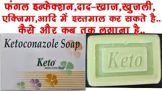 Keto Soap UsesBenefits Side Effects  Ketoconazole 2 ww Soap🔥🔥 [upl. by Casaleggio682]