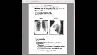 kettering A 19 to A 25 patient assessment radiographic imaging [upl. by Nrobyalc200]