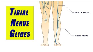 Flossing Exercises for TIBIAL NERVE ENTRAPMENT and TARSAL TUNNEL SYNDROME [upl. by Kelda]