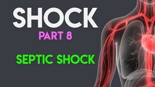 Septic Shock  Shock Part 8 [upl. by Ydiarf171]