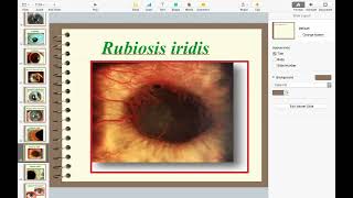 Ophthalmology Practical Slides 4 [upl. by Rannug]