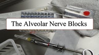 The Alveolar Nerve Blocks [upl. by Noby154]