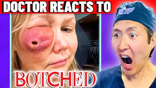 Plastic Surgeon Reacts to BOTCHED Facial Fillers Did THIS [upl. by Nossah]