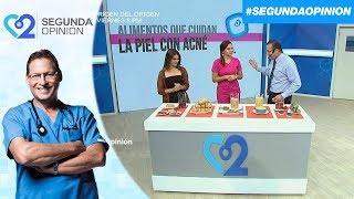 ¿Sabía que hay alimentos que cuidan nuestra piel del acné [upl. by Ketty]