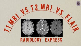 T1 MRI VS T2 MRI VS FLAIR  RADIOLOGY HOW TO IDENTIFY [upl. by Kassel]