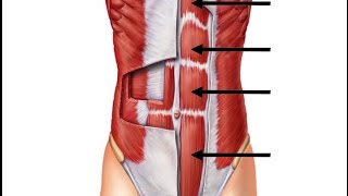 6MRECTUS ABDOMINISLINKS [upl. by Eldnik]