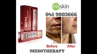 Filorga NCTF Mesotherapy [upl. by Evars]