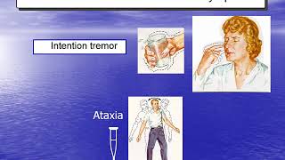 Demyelinating diseases [upl. by Leanor]