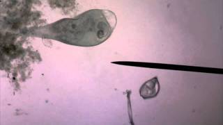 Live Stentor Swimming and Engorged on Euglena [upl. by Lleryd217]