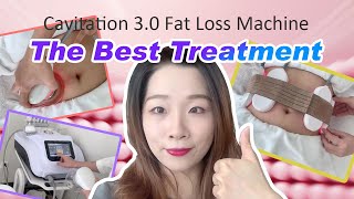 A Treatment Experience Video With Cavitation 30vacuumrf40kcavitationweightlossbodyslimming [upl. by Neelasor]