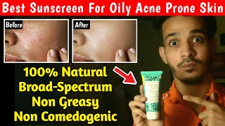 Oily Acne Prone Sensitive Skin के लिए सबसे अच्छा Sunscreen  Aroma Magic Aloe Vera Sunscreen Review🔥 [upl. by Niwroc]