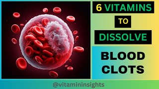 6 Vitamins to Dissolve Your Blood Clots Top Nutrients for a ClotFree Tomorrow [upl. by Aeriell]