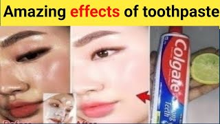 Toothpaste and lemon for skin whitening  Skin whitening home remedies live results  Lemon amp coffee [upl. by Lucania]