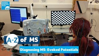 Diagnosing MS  Evoked potentials tests [upl. by Engel437]