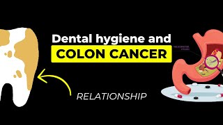 The MouthColon Connection Dental Hygiene and Cancer Risk [upl. by Dyoll]