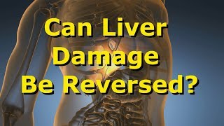 Can Liver Damage Be Reversed [upl. by Jayme]